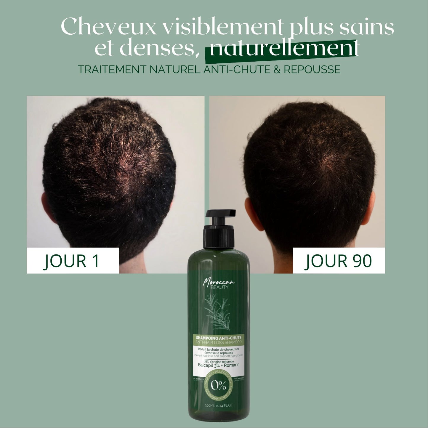 Natural Anti-Hair Loss & Hair Regrowth Shampoo – 3% Baicapil + Rosemary | 300 ml