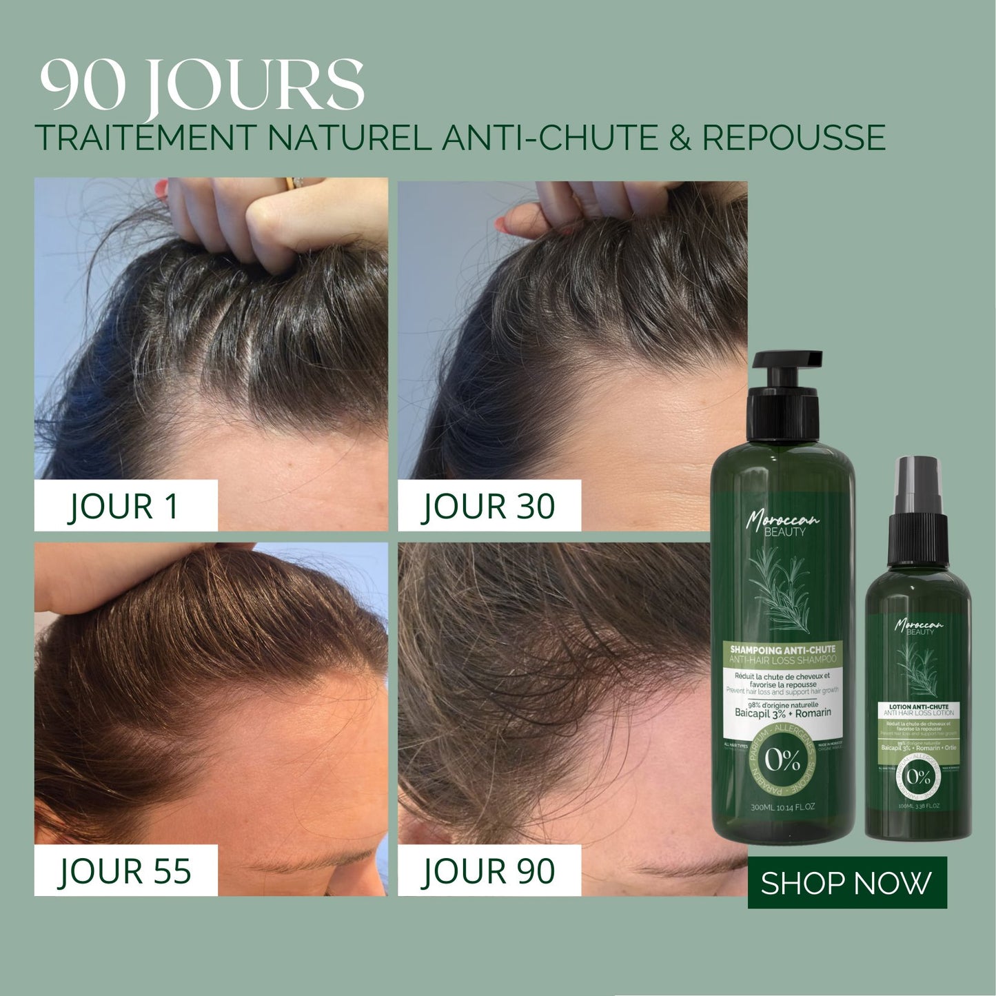 Natural Anti-Hair Loss & Regrowth Duo – Shampoo 300ml & Lotion 100ml – 90-Day Treatment