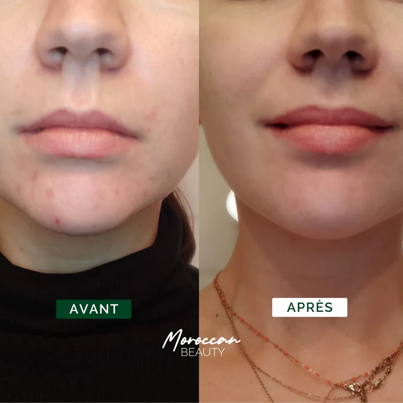 Purifying Duo - Atlas